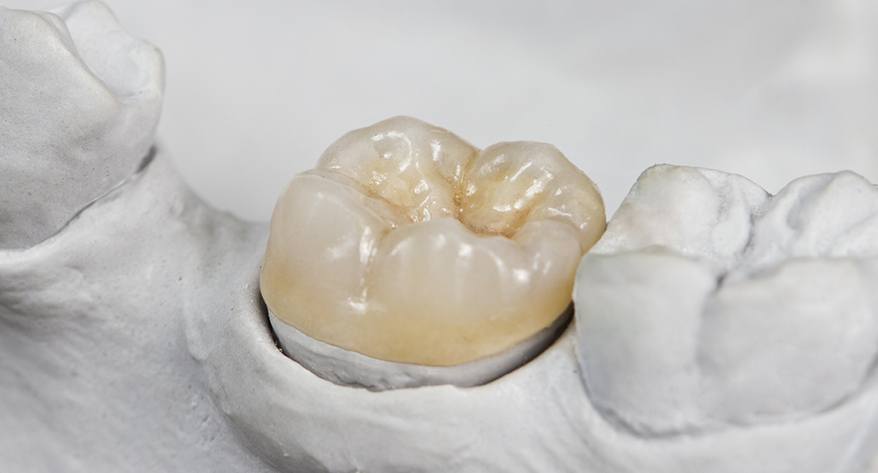 Restorative Dentistry in Sun City West