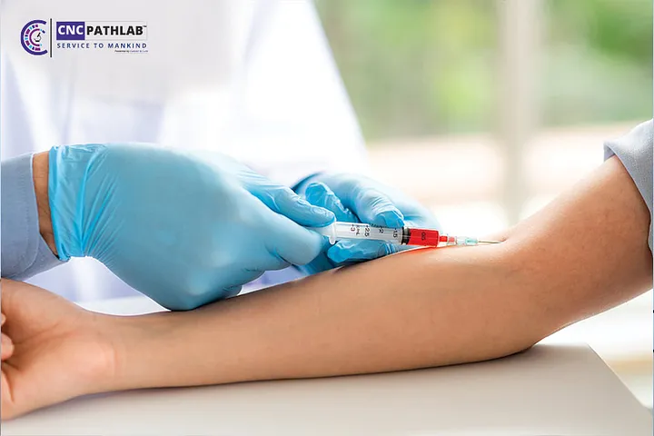 Affordable Blood Test Services in Dubai