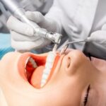 A Guide On Selecting The Best Ultrasonic Oral Appliance Cleaner